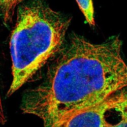 MOSPD2 Antibody, Novus Biologicals 25 &mu;L, Unlabeled:Antibodies, Polyclonal